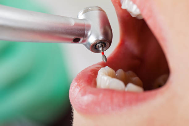 Best Emergency Treatment for Toothache in Rapid Valley, SD